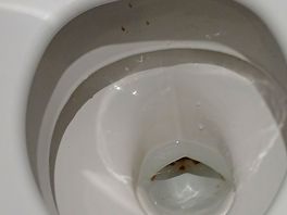 Dirty toilet rim
